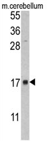 AP17383PU-N - FKBP2 / FKBP13