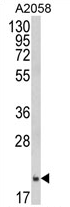 AP17403PU-N - Ferritin heavy chain (FTH1)