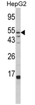 AP17405PU-N - Alpha-L-fucosidase 1 / FUCA1