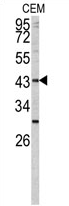 AP17406PU-N - Fucosyltransferase 1