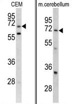AP17415PU-N - LRRC32 / GARP