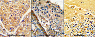 AP17415PU-N - LRRC32 / GARP