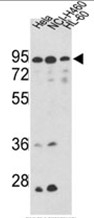AP17502PU-N - Mitofilin