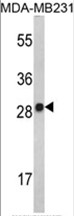 AP17501PU-N - Interleukin-2 / IL2