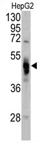 AP17424PU-N - Alpha-galactosidase A / GLA