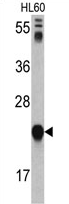 AP17425PU-N - Glyoxalase I / GLO1
