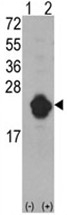 AP17499PU-N - IL1RN / IL1RA