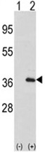 AP17498PU-N - Interleukin-1 alpha / IL-1A
