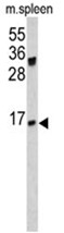 AP17496PU-N - Immunoglobulin J chain