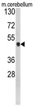 AP17428PU-N - Glutamine synthetase