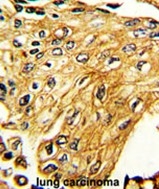 AP17492PU-N - IFNGR2 / IFNGT1
