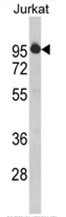 AP17490PU-N - HIV Tat-specific factor 1 / HTATSF1