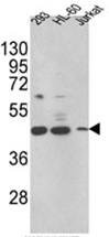 AP17485PU-N - 17-beta HSD7 / HSD17B7