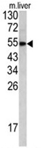 AP17484PU-N - Hemopexin / HPX
