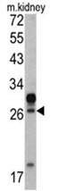 AP17479PU-N - HOXA5 / HOX1C