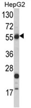 AP17475PU-N - mHMG-CoA synthase / HMGCS2