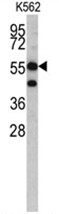 AP17474PU-N - HMG-CoA synthase / HMGCS