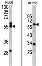 AP17473PU-N - HMG-CoA synthase / HMGCS