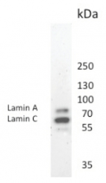 BM6000P - Lamin-A/C (LMNA)