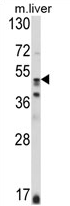 AP17441PU-N - Glutathione synthetase