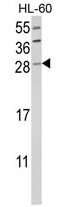 AP17448PU-N - Granzyme B (GZMB)