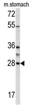 AP17449PU-N - Granzyme B (GZMB)