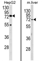 AP17459PU-N - Beta-hexosaminidase alpha / HEXA
