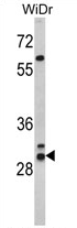 AP17469PU-N - HLA class II DR beta 1 / HLA-DRB1