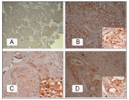 AM09256PU-N - PSMA / FOLH1