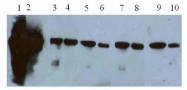 DM1040 - PTPN6