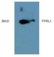 AM09318PU-N - FPR2 / FPRL1