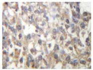 AP06470PU-N - TUBG1 / Tubulin gamma 1