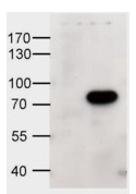 AP09620PU-N - ABCD1 / ALDP