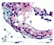 AP09633PU-N - FOXE1 / FKHL15