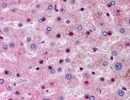 AP09609PU-N - NOS1AP