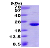 AR09416PU-L - HRAS