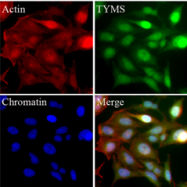 AM09355PU-N - Thymidylate synthase (TS)