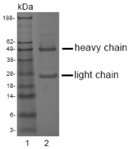 DM1223 - ACPP / Prostatic acid phosphatase