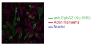 DM1226 - EPHA2 / ECK