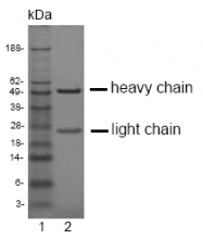 DM1226 - EPHA2 / ECK