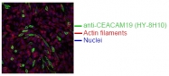 DM1230 - CEACAM19