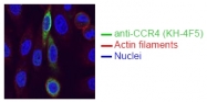 DM1232 - CD194 / CCR4