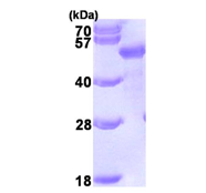 AR09432PU-L - SQSTM1