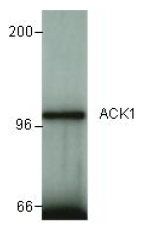 AP09880PU-N - TNK2 / ACK1