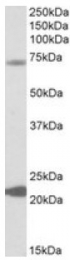 AP10032PU-N - KCNN2