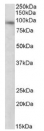 AP10034PU-N - DTX3 / RNF154