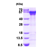AR09452PU-L - Calreticulin