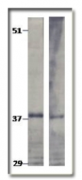 AP10354PU-N - TPD52