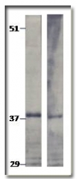 AP10355PU-N - TPD52