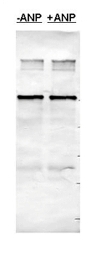 AP10239PU-N - PDE5A